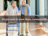 Osteoporosis – Causes, symptoms, Diagnosis and Treatment